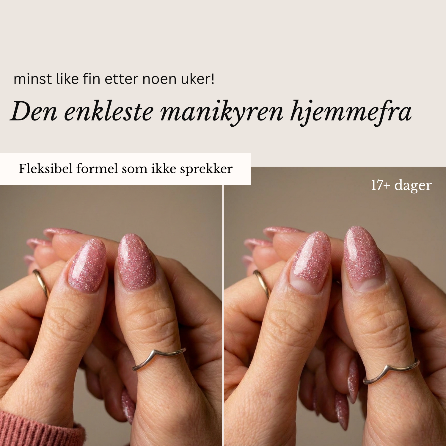 ONE STEP GEL STARTKIT